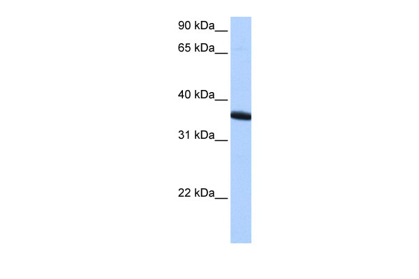 WB Suggested Anti-ZNF389 Antibody Titration: 0.2-1 ug/ml Positive Control: HepG2 cell lysate