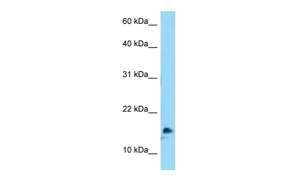 WB Suggested Anti-MYCNOS Antibody Titration: 1.0 ug/ml Positive Control: HepG2 Whole Cell