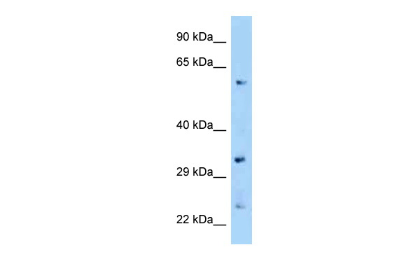 WB Suggested Anti-Zfp664 Antibody Titration: 1.0 ug/ml Positive Control: Mouse Kidney