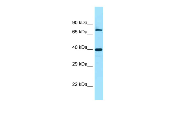 WB Suggested Anti-FAM54A Antibody Titration: 1.0 ug/ml Positive Control: 721_B Whole Cell