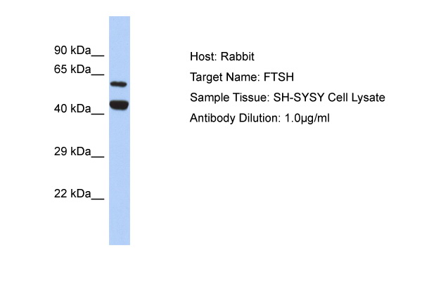 Host: Rabbit Target Name: FTSH Sample Type: SH-SYSY Whole cell lysates Antibody Dilution: 1.0ug/ml