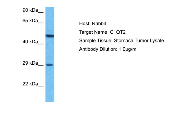 Host: Rabbit Target Name: C1QT2 Sample Type: Stomach Tumor lysates Antibody Dilution: 1.0ug/ml