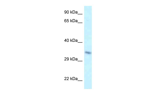 WB Suggested Anti-Taf8 Antibody Titration: 1.0 ug/ml Positive Control: Mouse Heart