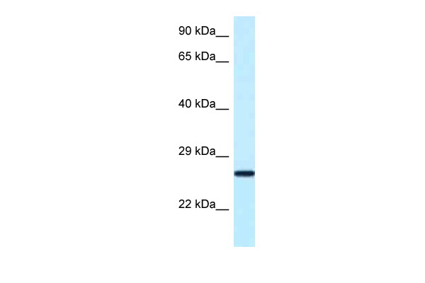 WB Suggested Anti-Nudt16 Antibody Titration: 1.0 ug/ml Positive Control: Mouse Small Intestine