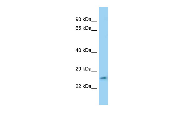 WB Suggested Anti-FAM71°C Antibody Titration: 1.0 ug/ml Positive Control: Jurkat Whole Cell
