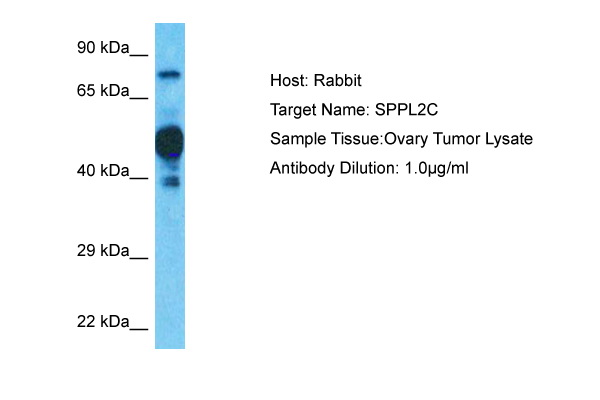 Host: Rabbit Target Name: SPPL2C Sample Type: Ovary Tumor lysates Antibody Dilution: 1.0ug/ml