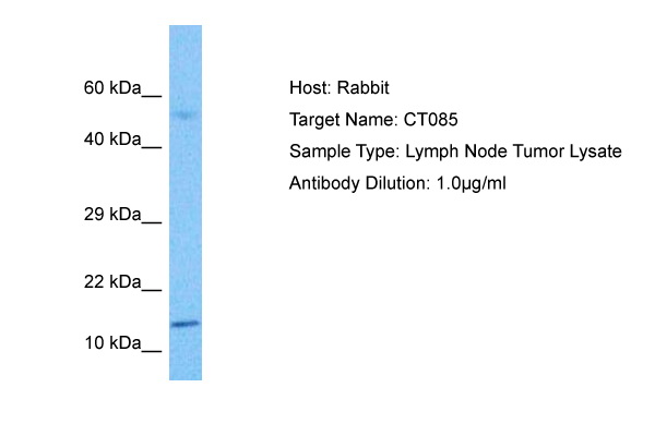 Host: Rabbit Target Name: CT085 Sample Tissue: Lymph Node Tumor lysates Antibody Dilution: 1ug/ml