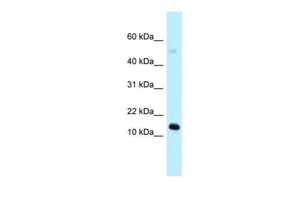 WB Suggested Anti-1110059E24Rik Antibody Titration: 1.0 ug/ml Positive Control: Mouse Heart