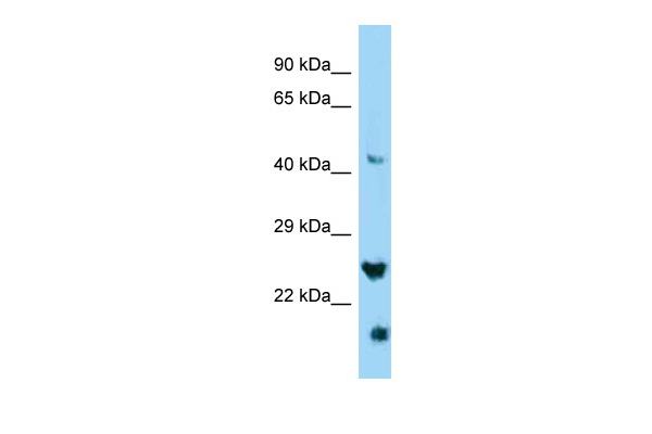 WB Suggested Anti-IZUMO4 Antibody Titration: 1.0 ug/ml Positive Control: HepG2 Whole Cell