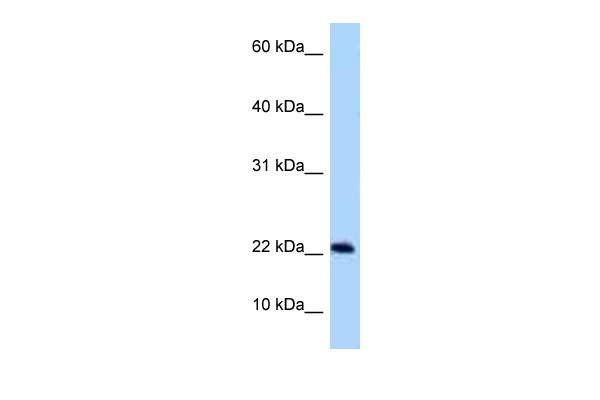 WB Suggested Anti-Rsb66 Antibody Titration: 1.0 ug/ml Positive Control: Rat Muscle