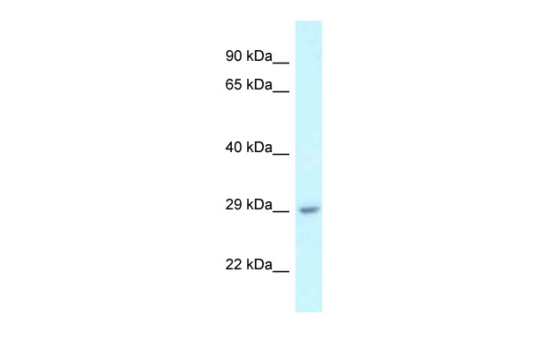 WB Suggested Anti-4933434E20Rik Antibody Titration: 1.0 ug/ml Positive Control: Mouse Liver