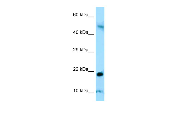 Host: Rabbit Target Name: AMELY Antibody Dilution: 1.0ug/ml Sample Type: Human Thymus