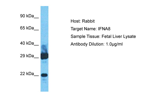 Host: Rabbit Target Name: IFNA8 Sample Type: Fetal Liver lysates Antibody Dilution: 1.0ug/ml