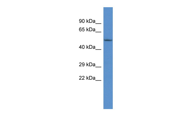 Western blot analysis of extracts of various cell lines, using Kaiso/Kaiso/ZBTB33 antibody (TA383439) at 1:3000 dilution.|Secondary antibody: HRP Goat Anti-Rabbit IgG (H+L) at 1:10000 dilution.|Lysates/proteins: 25ug per lane.|Blocking buffer: 3% nonfat dry milk in TBST.|Detection: ECL Enhanced Kit .|Exposure time: 90s.