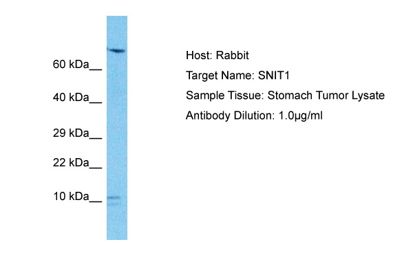 Host: Rabbit Target Name: SNIT1 Sample Type: Stomach Tumor lysates Antibody Dilution: 1.0ug/ml