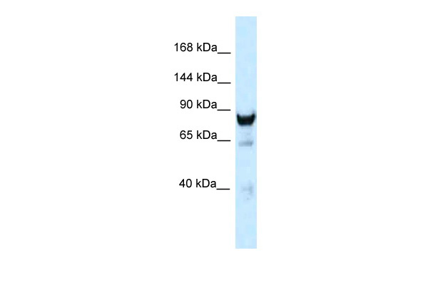 WB Suggested Anti-Dnm3 Antibody Titration: 1.0 ug/ml Positive Control: Mouse Brain