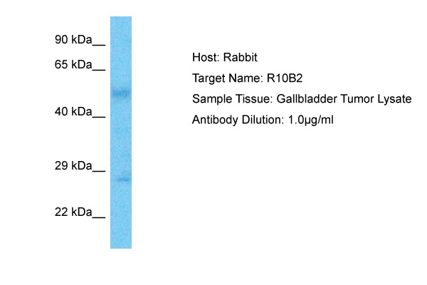 Host: Rabbit Target Name: R10B2 Sample Type: Gallbladder Tumor lysates Antibody Dilution: 1.0ug/ml
