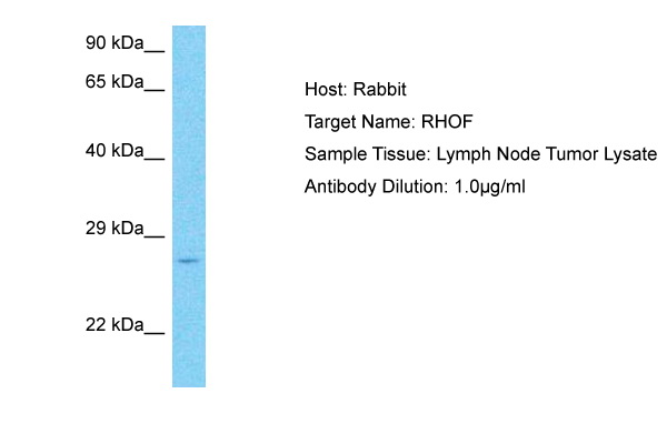 Host: Rabbit Target Name: RHOF Sample Type: Lymph Node Tumor lysates Antibody Dilution: 1.0ug/ml