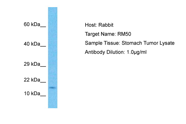 Host: Rabbit Target Name: RM50 Sample Type: Stomach Tumor lysates Antibody Dilution: 1.0ug/ml
