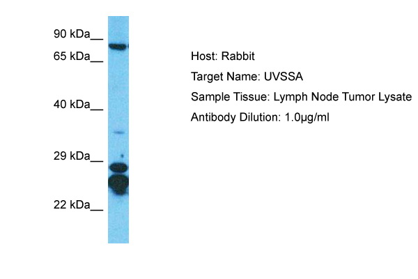 Host: Rabbit Target Name: UVSSA Sample Type: Lymph Node Tumor lysates Antibody Dilution: 1.0ug/ml