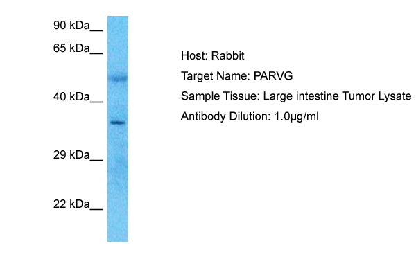 Host: Rabbit Target Name: PARVG Sample Type: Large intestine Tumor lysates Antibody Dilution: 1ug/ml