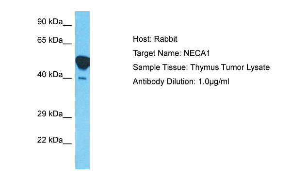 Host: Rabbit Target Name: NECA1 Sample Type: Thymus Tumor lysates Antibody Dilution: 1.0ug/ml