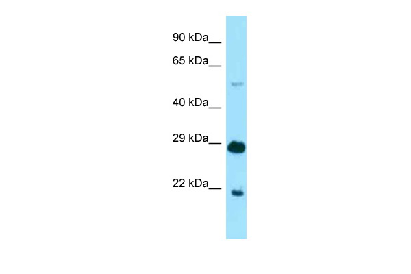 Western blot analysis of extracts of various cell lines, using pan-Ubiquitin Remnant Motif (K-ε-GG) antibody (TA383638) at 1:1000 dilution.HeLa cells were treated by MG132(50 μM) at 37℃ for 90 minutes.|Secondary antibody: HRP Goat Anti-Rabbit IgG (H+L) at 1:10000 dilution.|Lysates/proteins: 25ug per lane.|Blocking buffer: 3% nonfat dry milk in TBST.|Detection: ECL Enhanced Kit .|Exposure time: 180s.