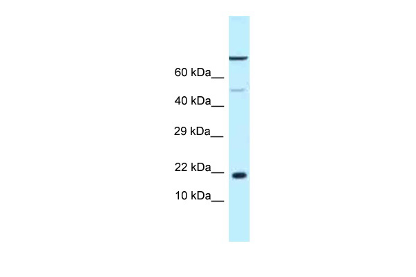 WB Suggested Anti-LOC683991 Antibody Titration: 1.0 ug/ml Positive Control: Rat Lung