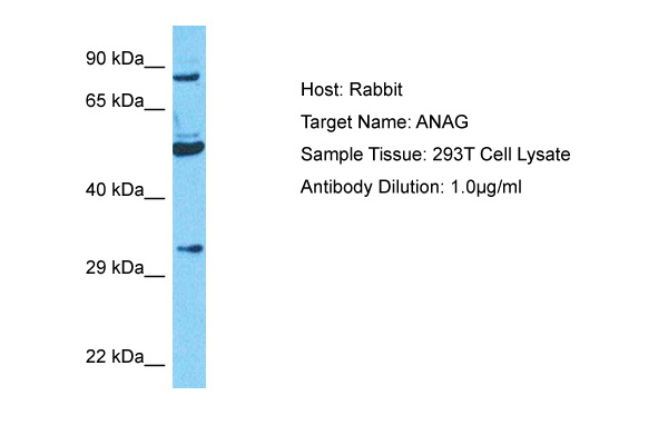 Host: Rabbit Target Name: NAGLU Sample Type: 293T Whole Cell lysates Antibody Dilution: 1.0ug/ml