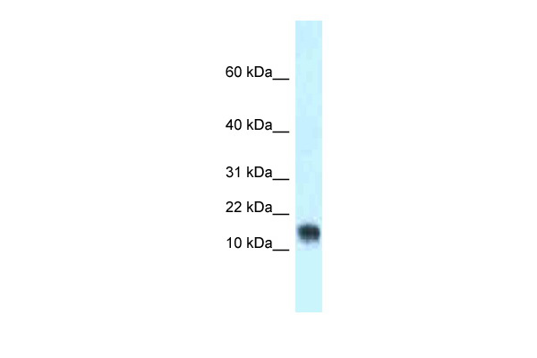WB Suggested Anti-Lynx1 Antibody Titration: 1.0 ug/ml Positive Control: Mouse Heart