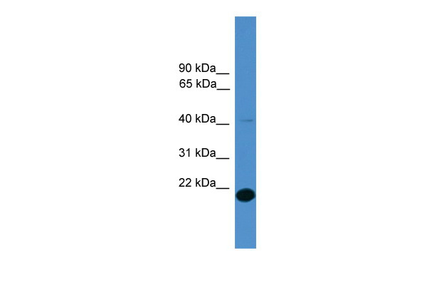 WB Suggested Anti-TMEM166 Antibody Titration: 0.2-1 ug/ml ELISA Titer: 1:312500 Positive Control: 293T cell lysate