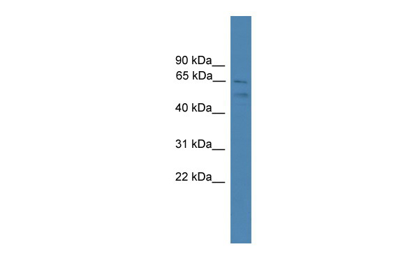 WB Suggested Anti-SPATA2 Antibody Titration: 0.2-1 ug/ml ELISA Titer: 1:1562500 Positive Control: PANC1 cell lysate