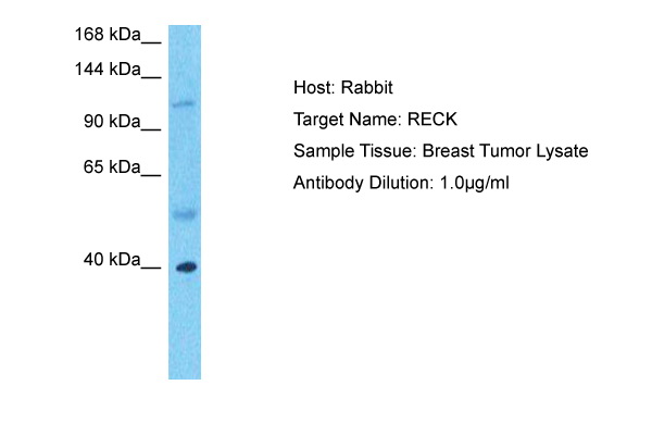 Host: Rabbit Target Name: RECK Sample Type: Breast Tumor lysates Antibody Dilution: 1.0ug/ml