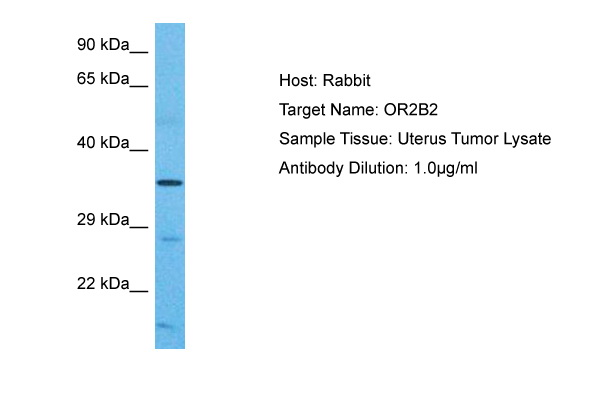 WB Suggested Anti-OR2B2 antibody Titration: 1 ug/mL Sample Type: Human Uterus Tumor