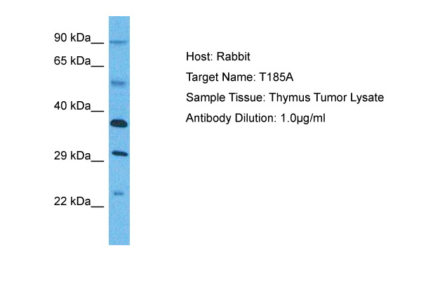 WB Suggested Anti-T185A antibody Titration: 1 ug/mL Sample Type: Human Thymus Tumor