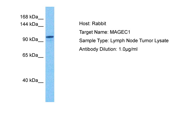 Host: Rabbit Target Name: MAGEC1 Sample Tissue: Human Lymph Node Tumor lysates Antibody Dilution: 1ug/ml