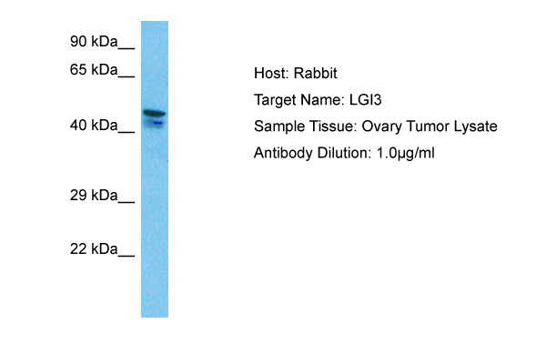 WB Suggested Anti-LGI3 antibody Titration: 1 ug/mL Sample Type: Human Ovary Tumor