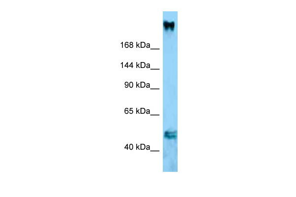 HEK293T cells were transfected with the pCMV6-ENTRY control (Cat# PS100001, Left lane) or pCMV6-ENTRY CCNB1 (Cat# RC200812, Right lane) cDNA for 48 hrs and lysed. Equivalent amounts of cell lysates (5ug per lane) were separated by SDS-PAGE and immunoblotted with anti-CCNB1(Cat# TA590439).