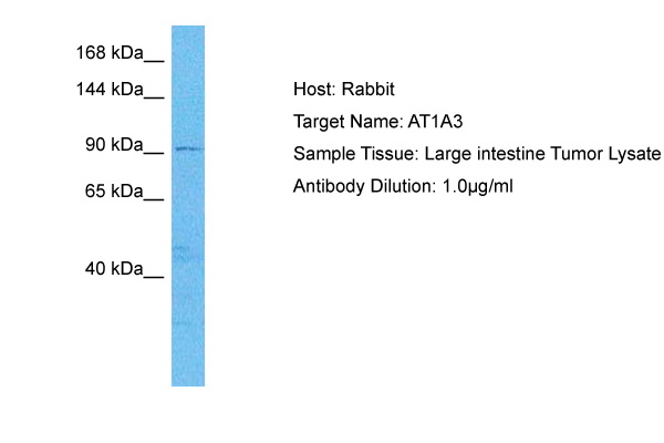 WB Suggested Anti-AT1A3 antibody Titration: 1 ug/mL Sample Type: Human Large intestine Tumor