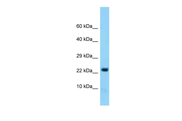 WB Suggested Anti-Hint2 Antibody Titration: 1.0 ug/ml Positive Control: Mouse Brain