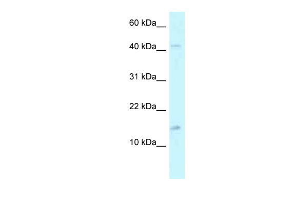 WB Suggested Anti-PCBD2 Antibody Titration: 1.0 ug/ml Positive Control: THP-1 Whole Cell