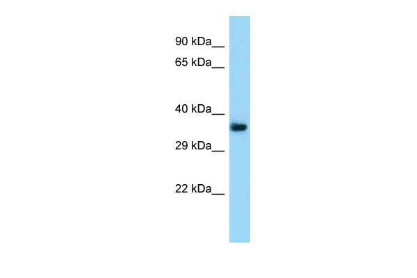 WB Suggested Anti-Tmem164 Antibody Titration: 1.0 ug/ml Positive Control: Mouse Kidney