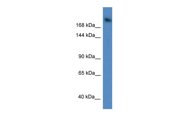 WB Suggested Anti-WDR87 Antibody Titration: 1.0 ug/ml Positive Control: A549 Whole Cell