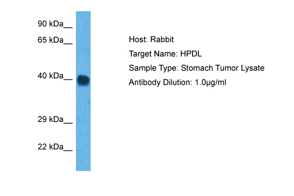 Host: Rabbit Target Name: HPDL Sample Tissue: Human Stomach Tumor lysates Antibody Dilution: 1ug/ml