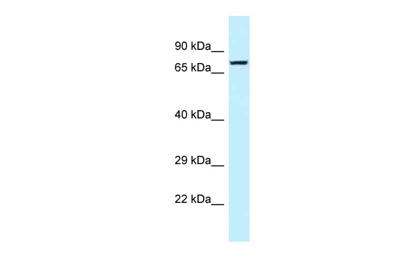 WB Suggested Anti-TNS4 Antibody Titration: 1.0 ug/ml Positive Control: MCF7 Whole Cell