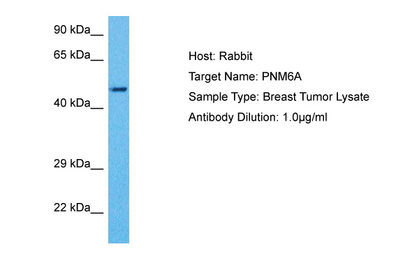 Host: Rabbit Target Name: PNM6A Sample Tissue: Human Breast Tumor lysates Antibody Dilution: 1ug/ml