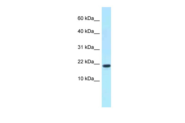 WB Suggested Anti-XAGE1D Antibody Titration: 1.0 ug/ml Positive Control: Fetal kidney