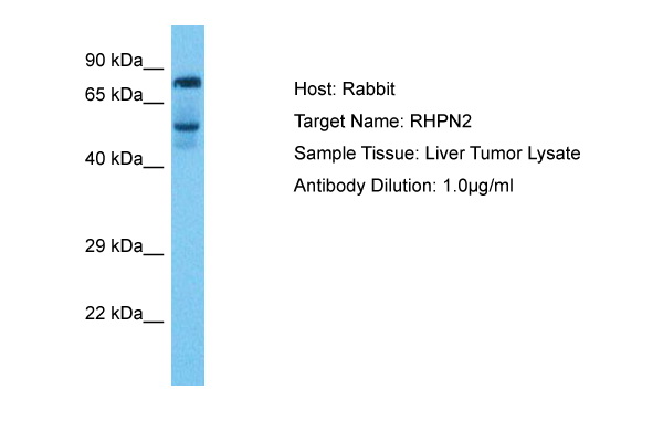 Host: Rabbit Target Name: RHPN2 Sample Type: Liver Tumor Antibody Dilution: 1.0ug/ml