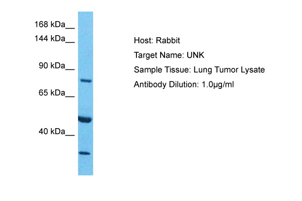 Host: Rabbit Target Name: UNK Sample Type: Lung Tumor Antibody Dilution: 1.0ug/ml
