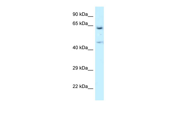 Western blot analysis of extracts from HEK293 cells transfected with C-terminal HA-tagged gene (lane 2, 3, 4, with 5, 10, 20uL from left to right) and negative control vector (lane 1) using anti-HA tag rabbit monoclonal antibody (TA591010) at 1:2000 dilution.